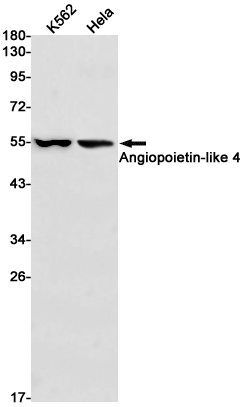 Angiopoietin Like 4 Rabbit mAb