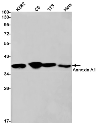 Annexin A1 Rabbit mAb