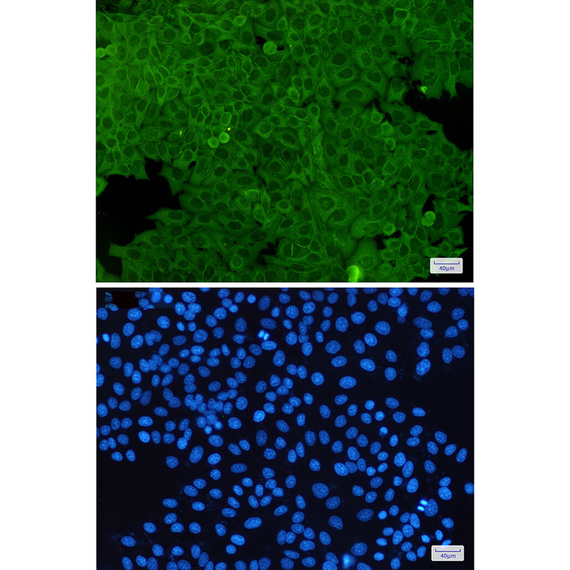 Annexin A2 Rabbit mAb