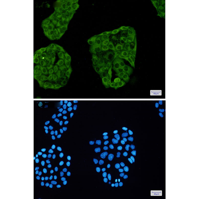 Annexin VI Rabbit mAb