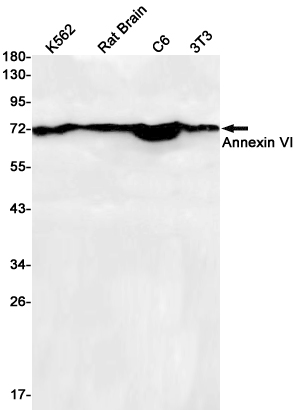 Annexin VI Rabbit mAb