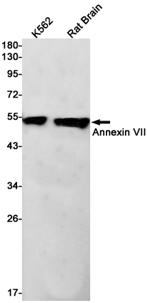 Annexin VII Rabbit mAb