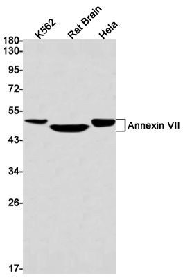 Annexin VII Rabbit mAb