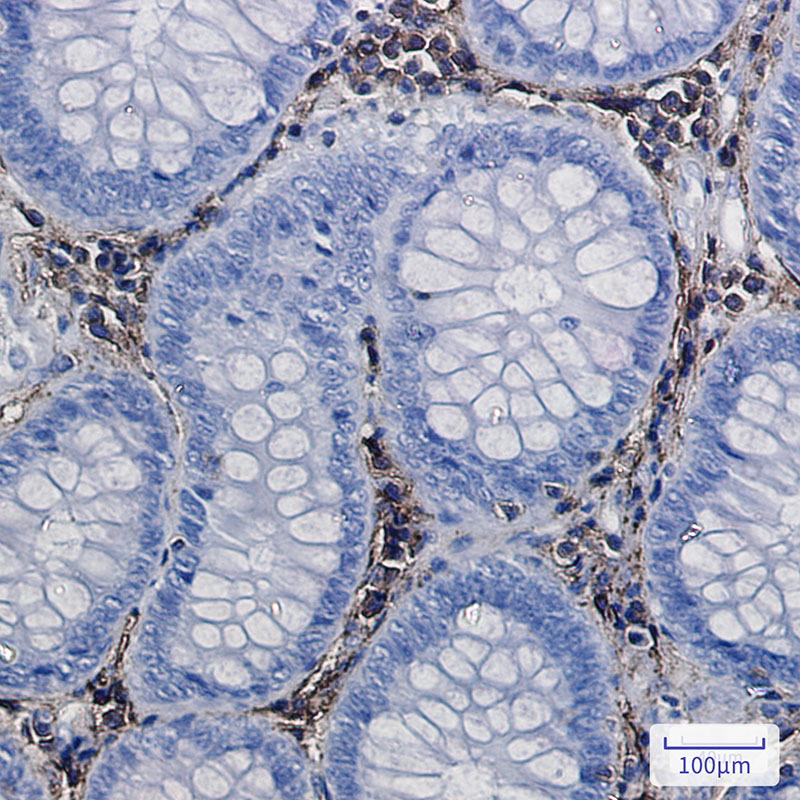 Annexin VI Rabbit mAb