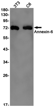 Annexin VI Rabbit mAb