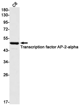 AP2 alpha Rabbit mAb