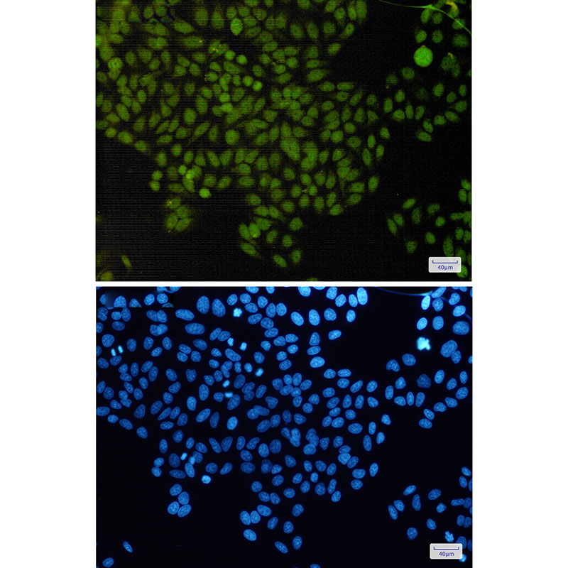 APE1 Rabbit mAb