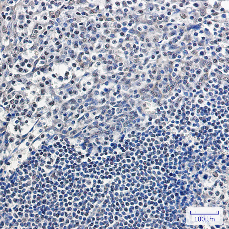 APE1 Rabbit mAb