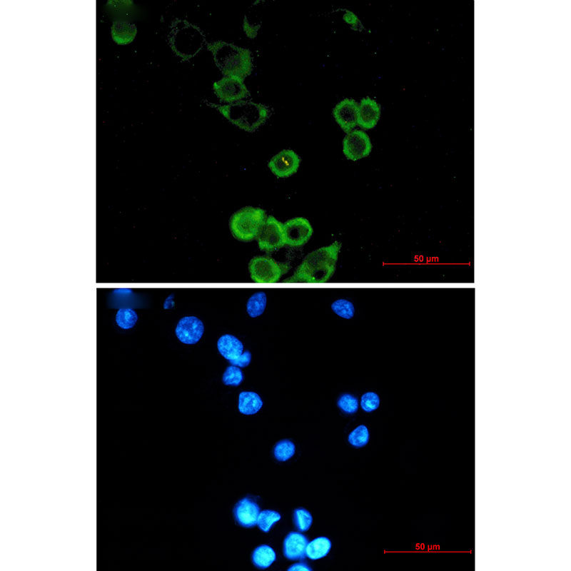 APG5L Rabbit mAb