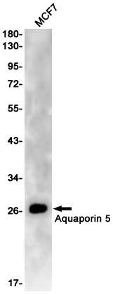 Aquaporin 5 Rabbit mAb