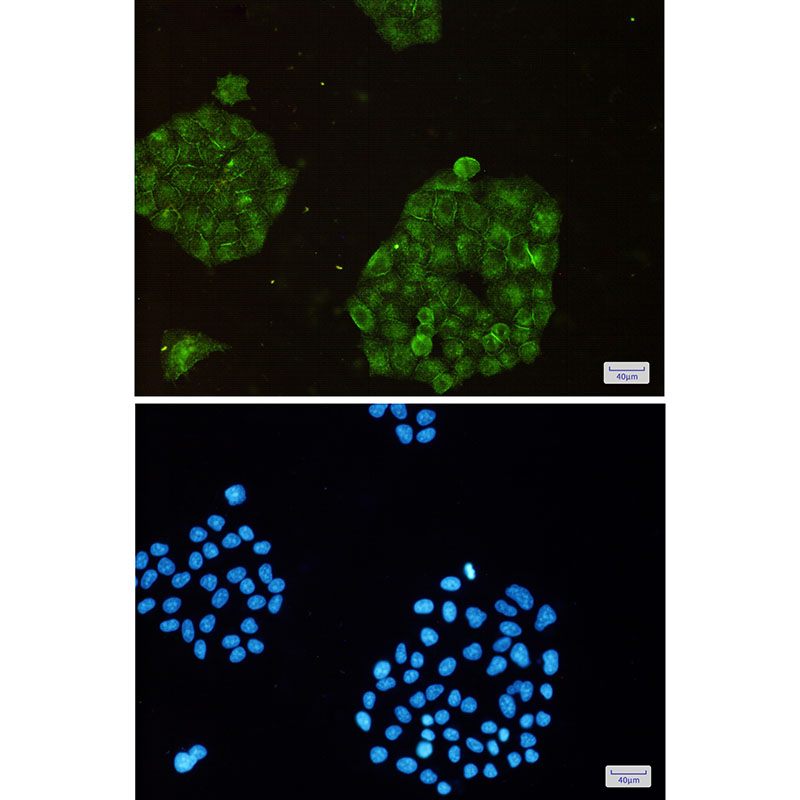 ARPC2 Rabbit mAb