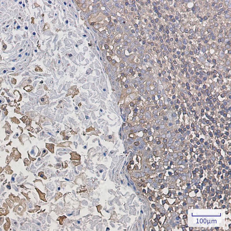 ARPC2 Rabbit mAb