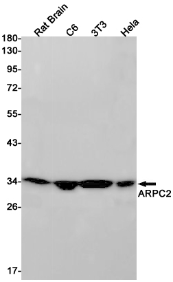 ARPC2 Rabbit mAb