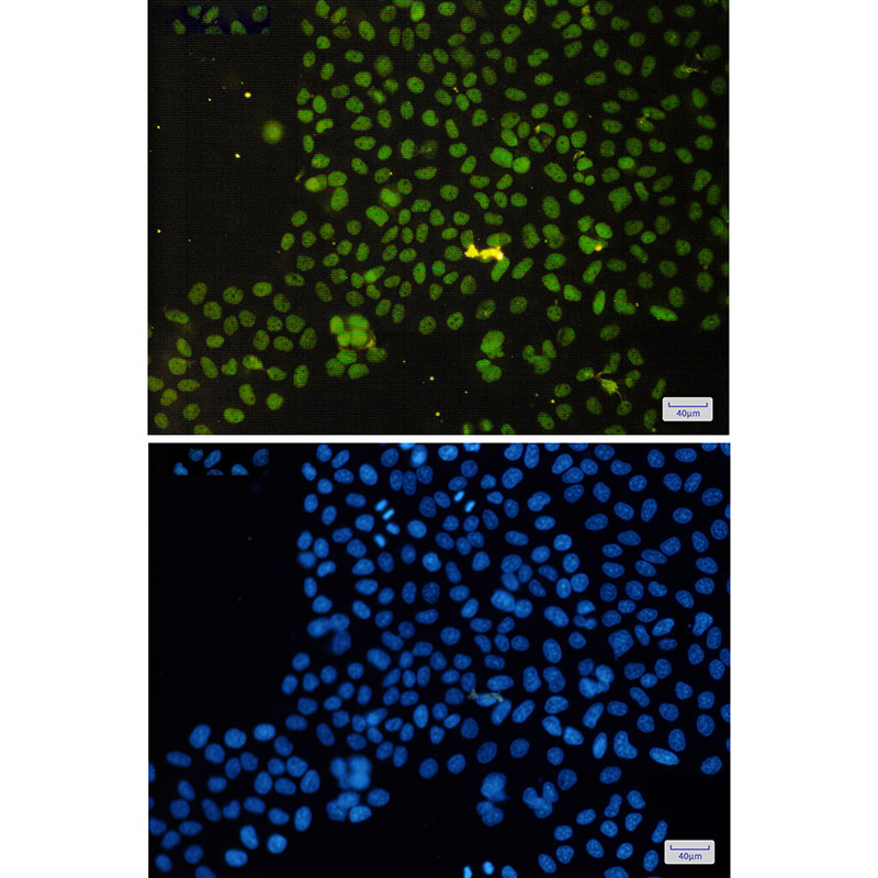 ASH2L Rabbit mAb