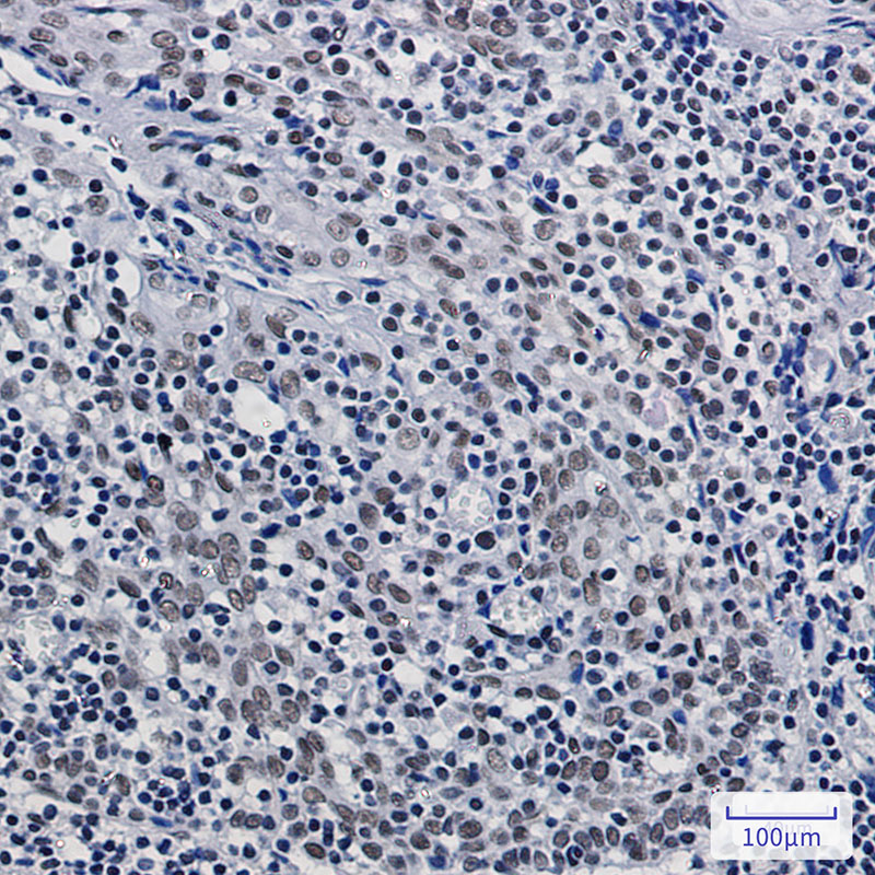 ASH2L Rabbit mAb