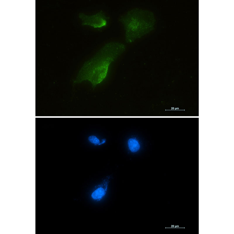 Aspartate Aminotransferase Rabbit mAb