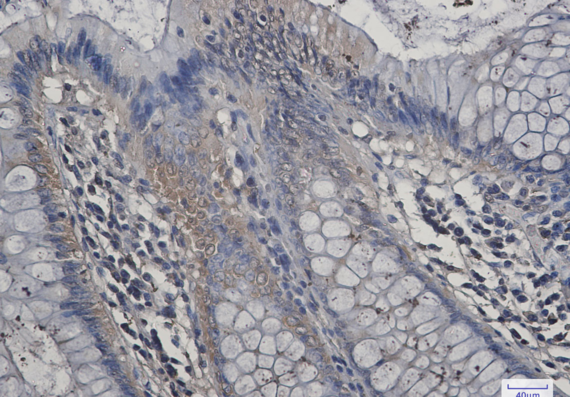 Aspartate Aminotransferase Rabbit mAb