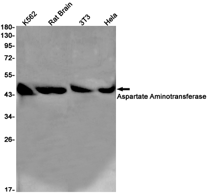 Aspartate Aminotransferase Rabbit mAb