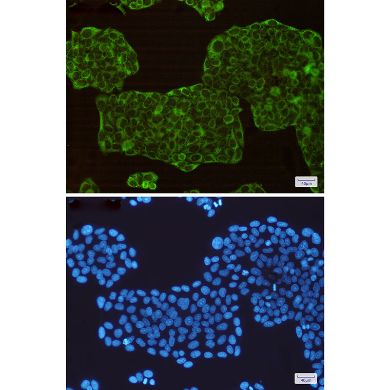 ASS1 Rabbit mAb