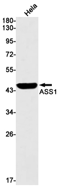 ASS1 Rabbit mAb