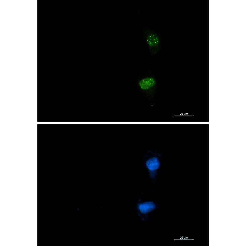 Phospho-ATF2 (Thr71) Rabbit mAb