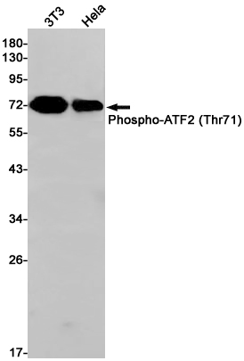 Phospho-ATF2 (Thr71) Rabbit mAb