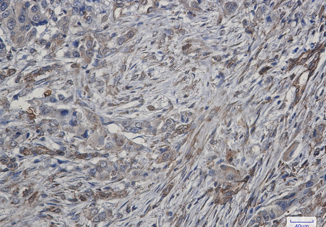 ATG4C Rabbit mAb