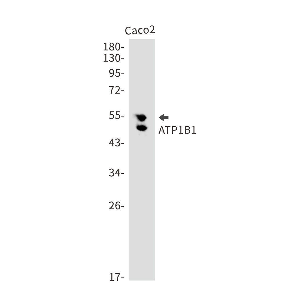 ATP1B1 Rabbit mAb