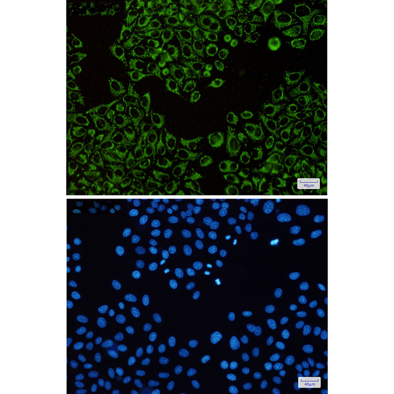 ATPB Rabbit mAb