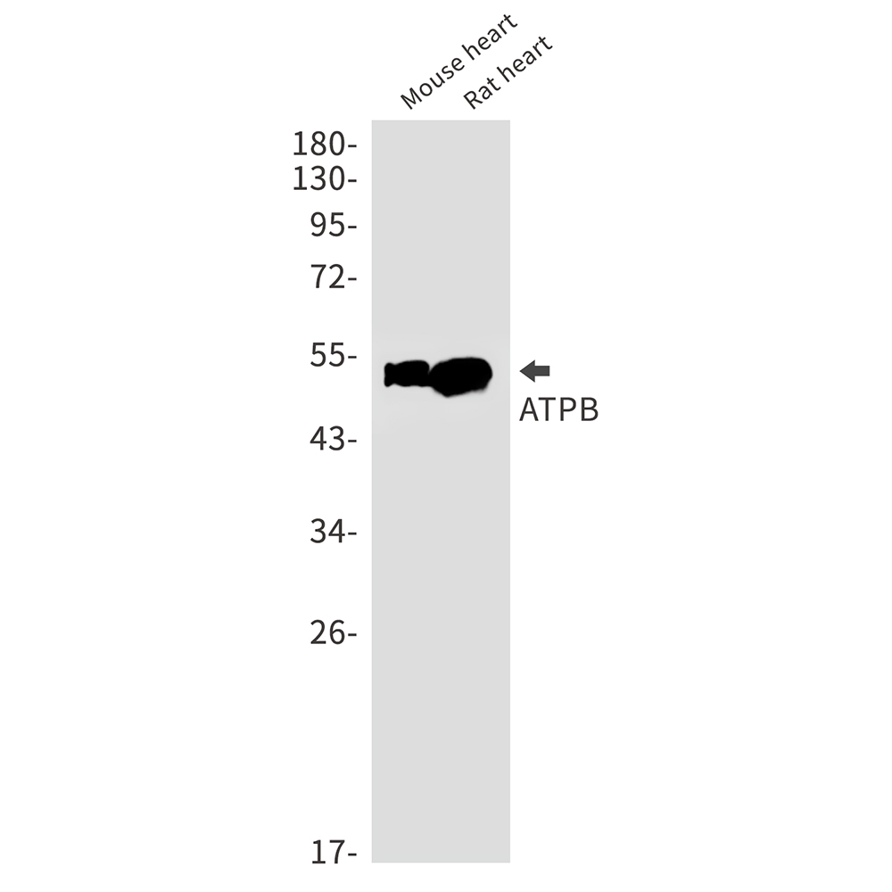 ATPB Rabbit mAb