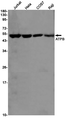 ATPB Rabbit mAb