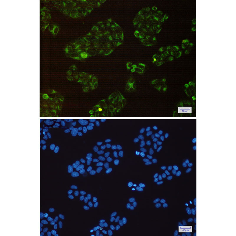 BAP31 Rabbit mAb