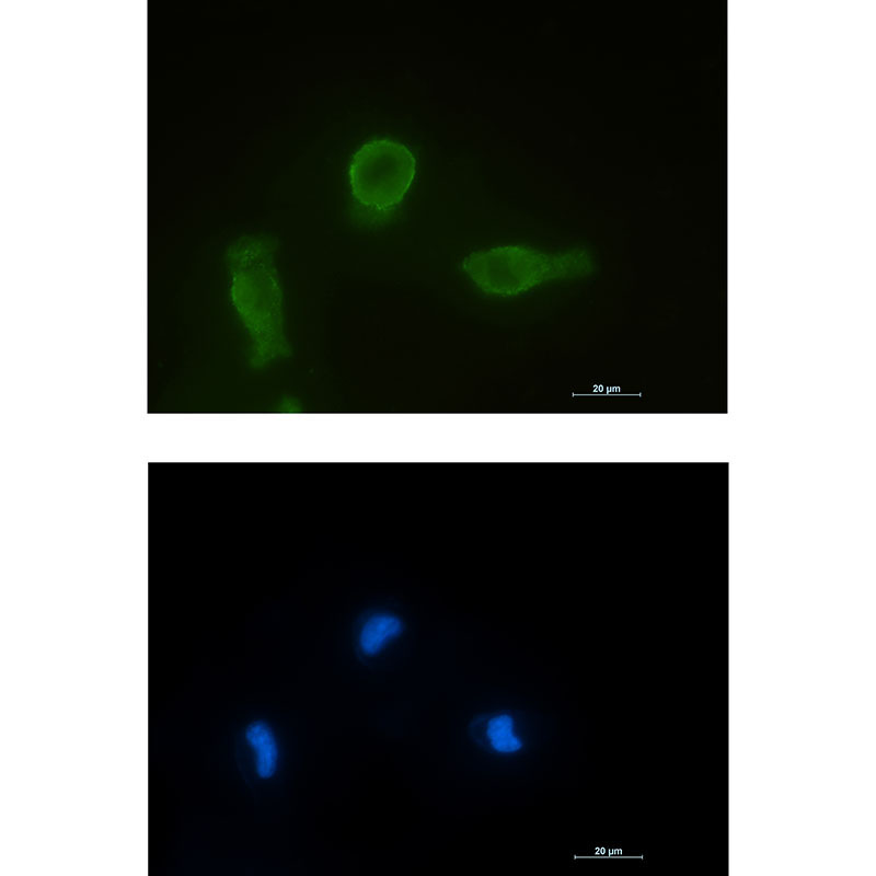 Bcl-XL Rabbit mAb