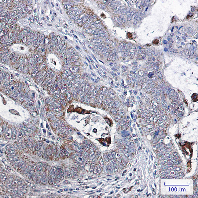 Bcl-XL Rabbit mAb