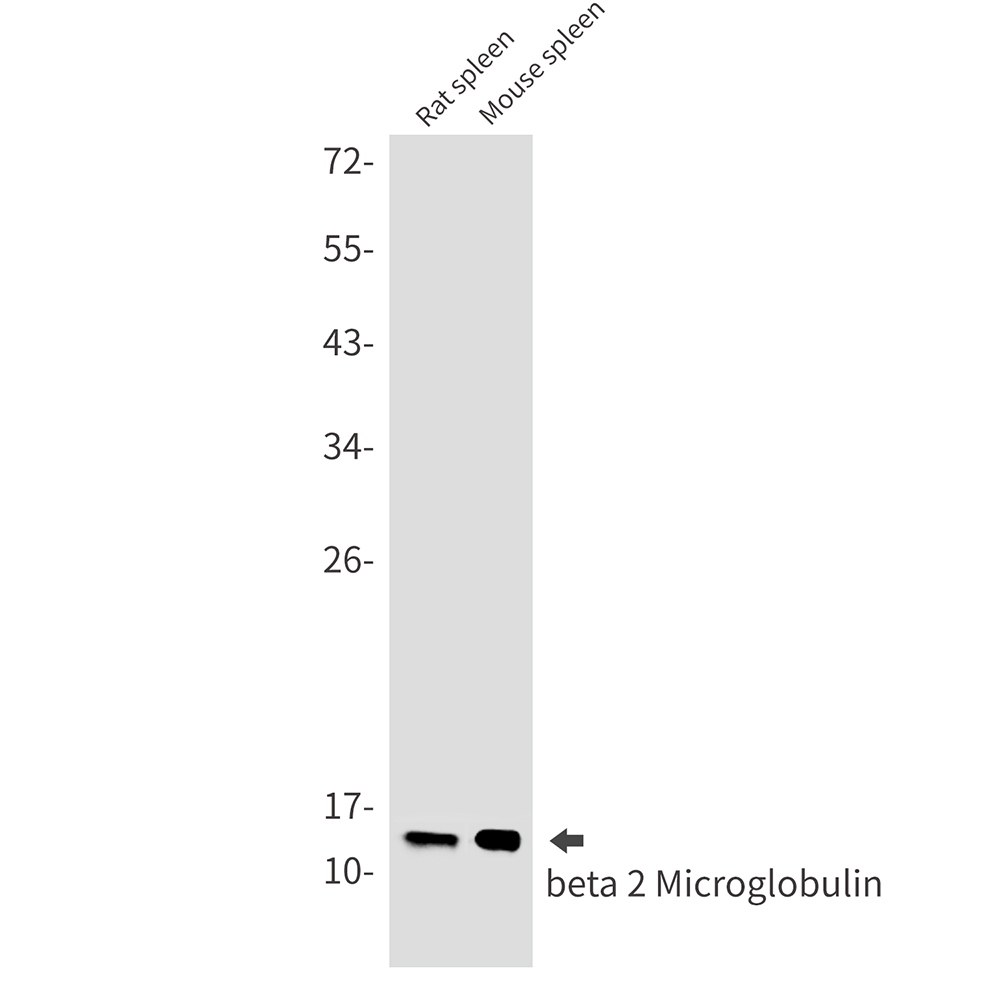 beta 2 Microglobulin Rabbit mAb