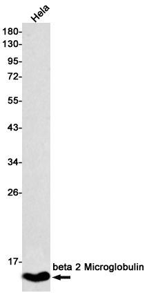 beta 2 Microglobulin Rabbit mAb