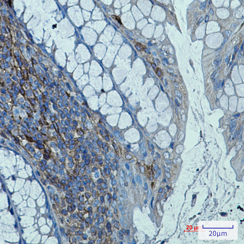 beta 2 Microglobulin Rabbit mAb