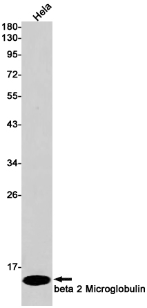 beta 2 Microglobulin Rabbit mAb