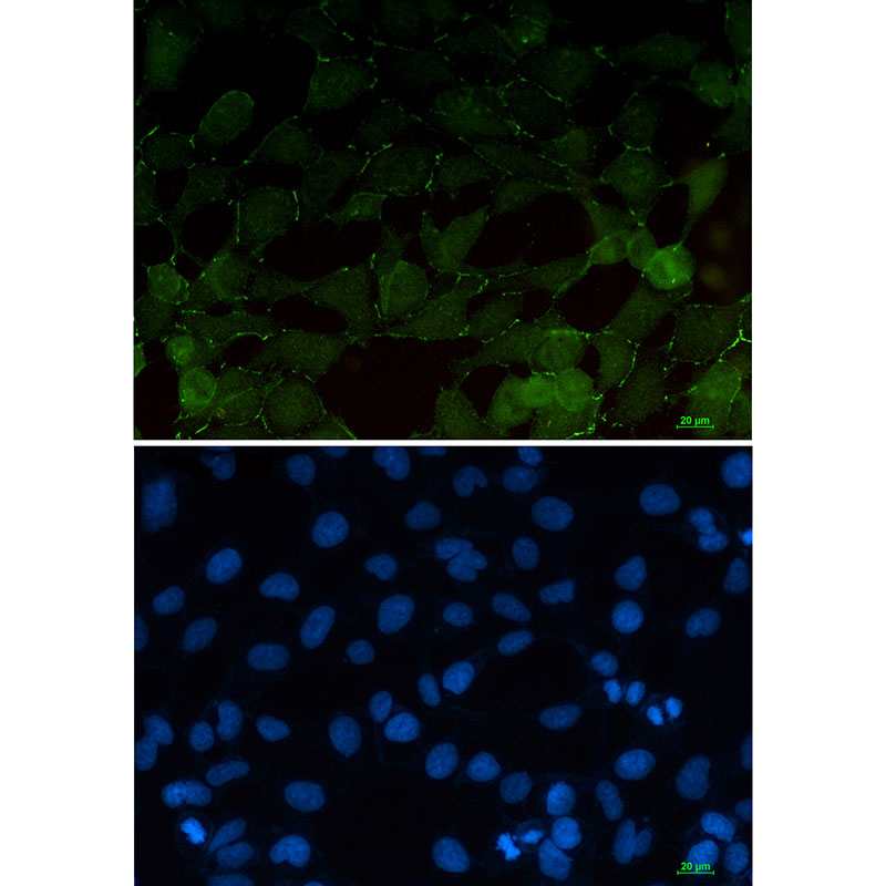 beta Catenin Rabbit mAb