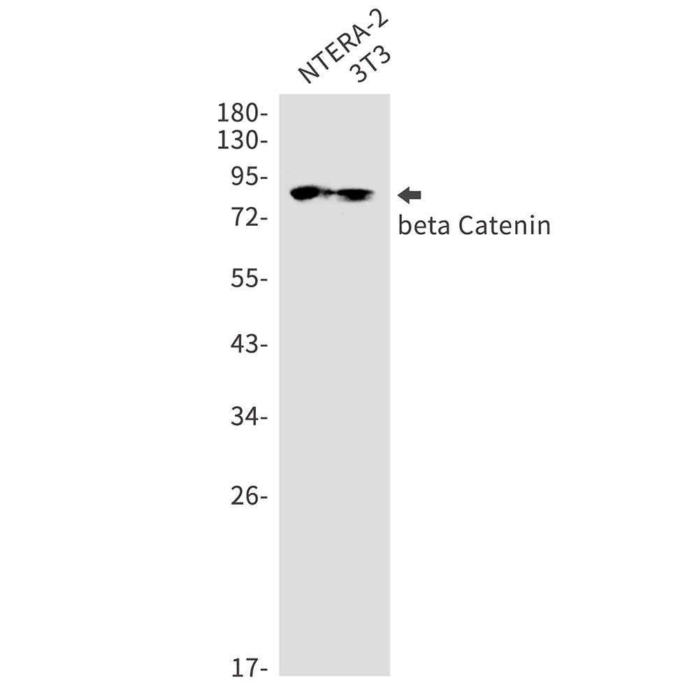 beta Catenin Rabbit mAb