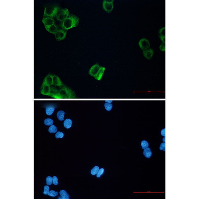 beta III Tubulin Rabbit mAb