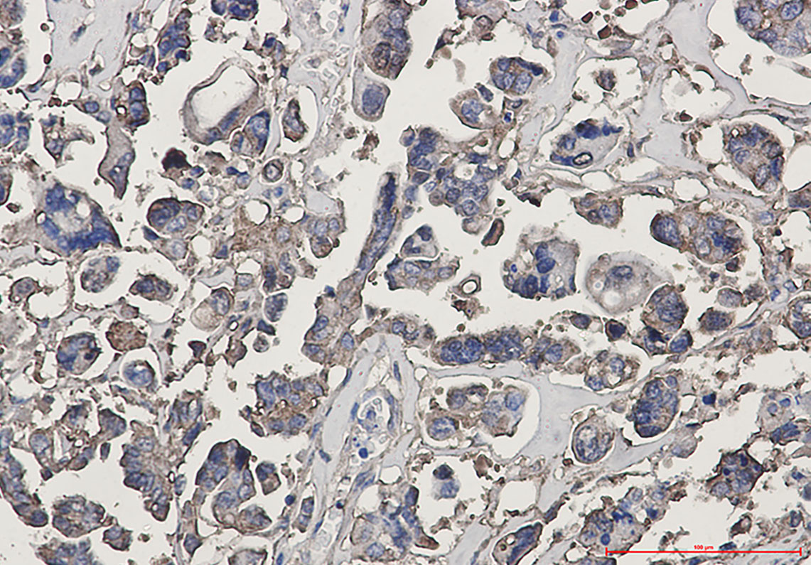 beta III Tubulin Rabbit mAb