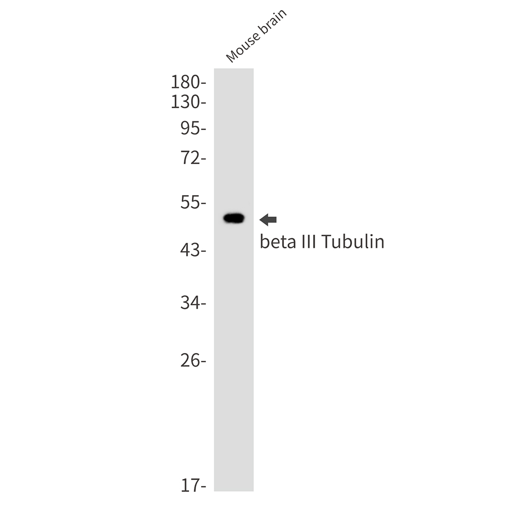 beta III Tubulin Rabbit mAb