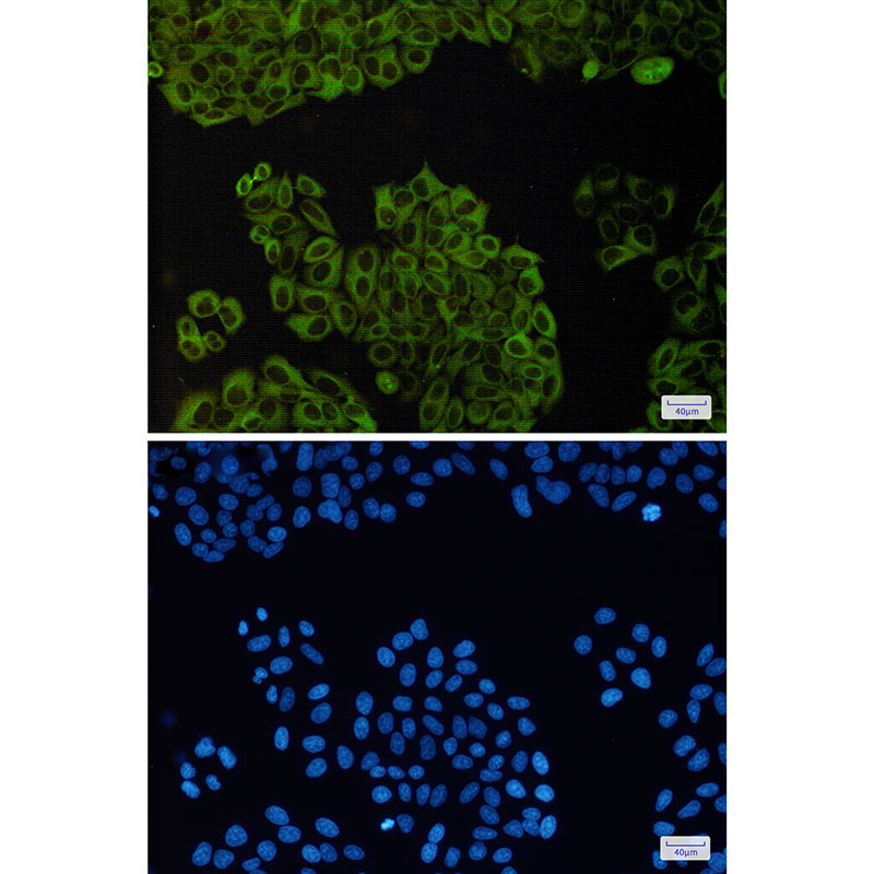 beta III Tubulin Rabbit mAb