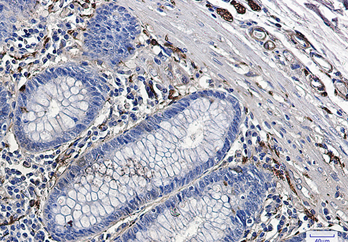 beta III Tubulin Rabbit mAb