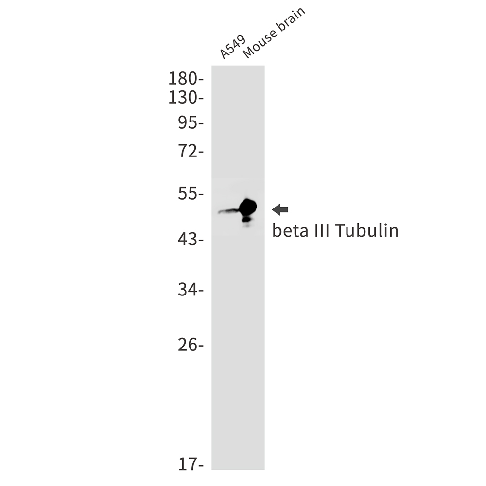 beta III Tubulin Rabbit mAb