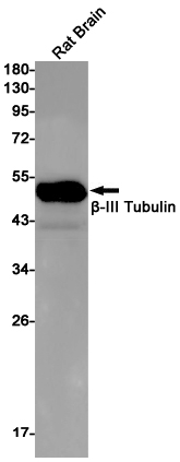 beta III Tubulin Rabbit mAb