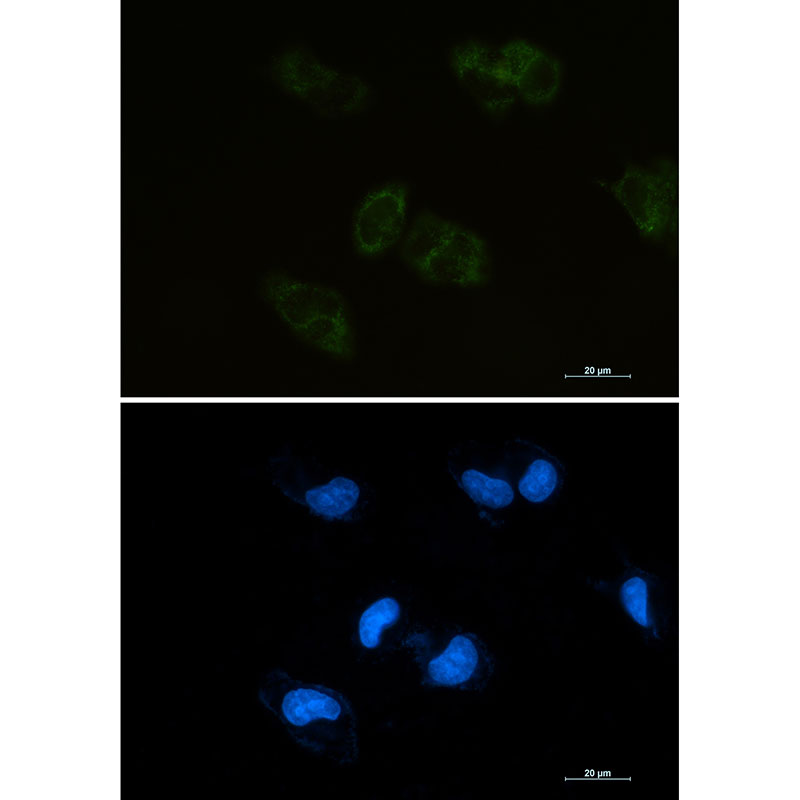 BMP4 Rabbit mAb