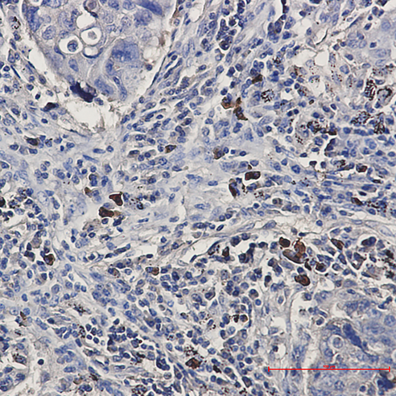 BNIP3L Rabbit mAb