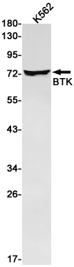 BTK Rabbit mAb